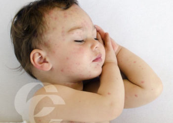 Czy potrzebujesz porady doświadczonego Dermatologa?