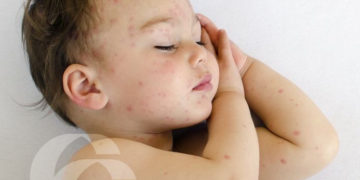 Czy potrzebujesz porady doświadczonego Dermatologa?