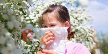 Wiosna to przyjemny czas, ale nie dla wszystkich!