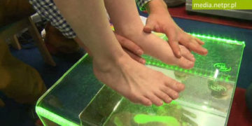 Zdrowe stopy u dziecka, czyli jak rozpoznać i leczyć płaskostopie