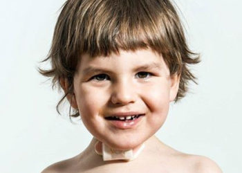 „Leoaukcja” – pomagamy Leosiowi!