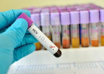 Bezpłatne badania HCV w Warszawie