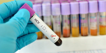 Bezpłatne badania HCV w Warszawie