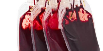 Kto, przede wszystkim, powinien skorzystać z możliwości przechowywania komórek macierzystych dziecka?