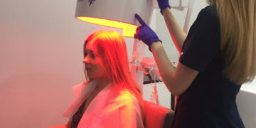 Łuszczyca skóry głowy – przyczyny, objawy i leczenie