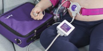 Zadbaj o bezpieczeństwo w ciąży! Zamów już dziś mobilne KTG Pregnabit