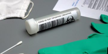 Wszystko o testach na koronawirusa
