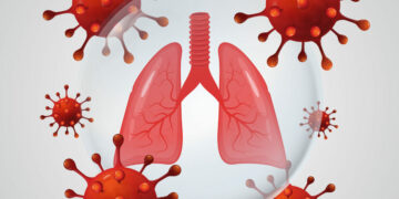 Płuca po COVID-19
