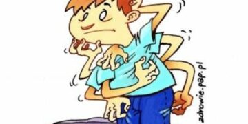 AZS to nie banalna wysypka