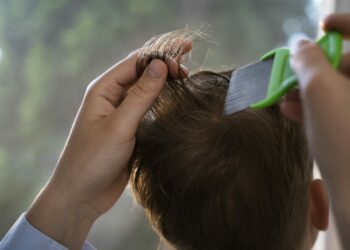 Wszawica u dziecka – jak skutecznie rozpoznać, leczyć i zapobiegać nawrotom w dużym mieście?