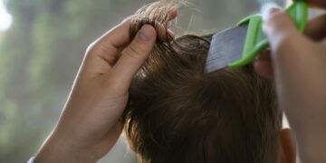 Wszawica u dziecka – jak skutecznie rozpoznać, leczyć i zapobiegać nawrotom w dużym mieście?