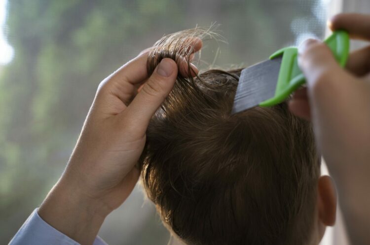 Wszawica u dziecka – jak skutecznie rozpoznać, leczyć i zapobiegać nawrotom w dużym mieście?